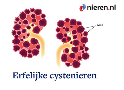 Erfelijke cystenieren